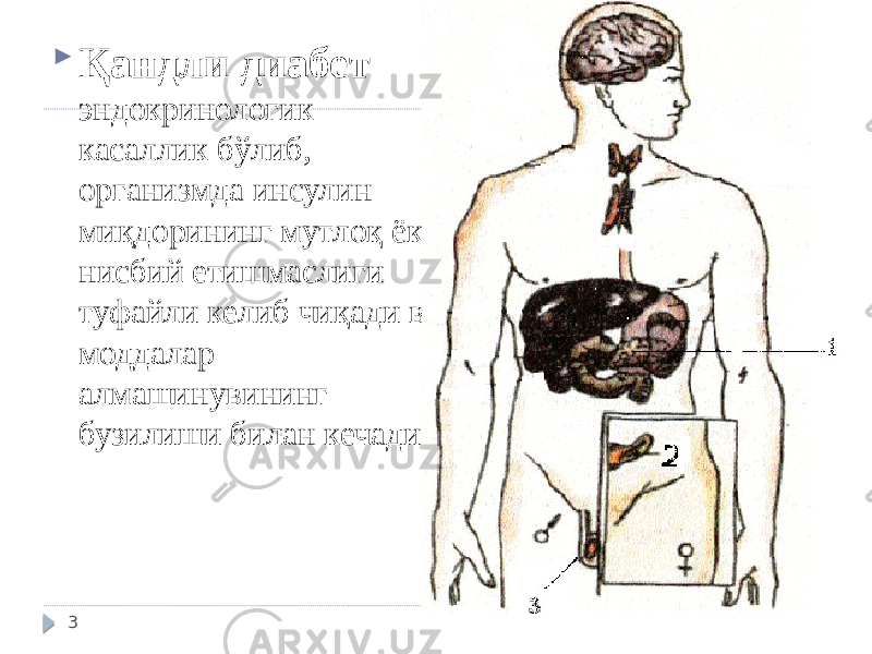  Қандли диабет эндокринологик касаллик бўлиб, организмда инсулин миқдорининг мутлоқ ёки нисбий етишмаслиги туфайли келиб чиқади ва моддалар алмашинувининг бузилиши билан кечади 3 