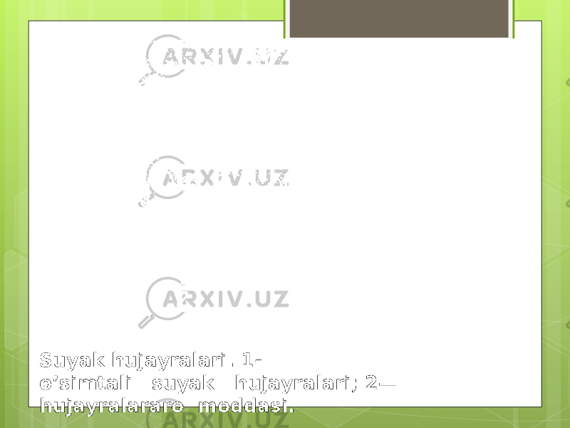 Suyak hujayralari. 1- o’simtali   suyak   hujayralari; 2— hujayralararo  moddasi. 