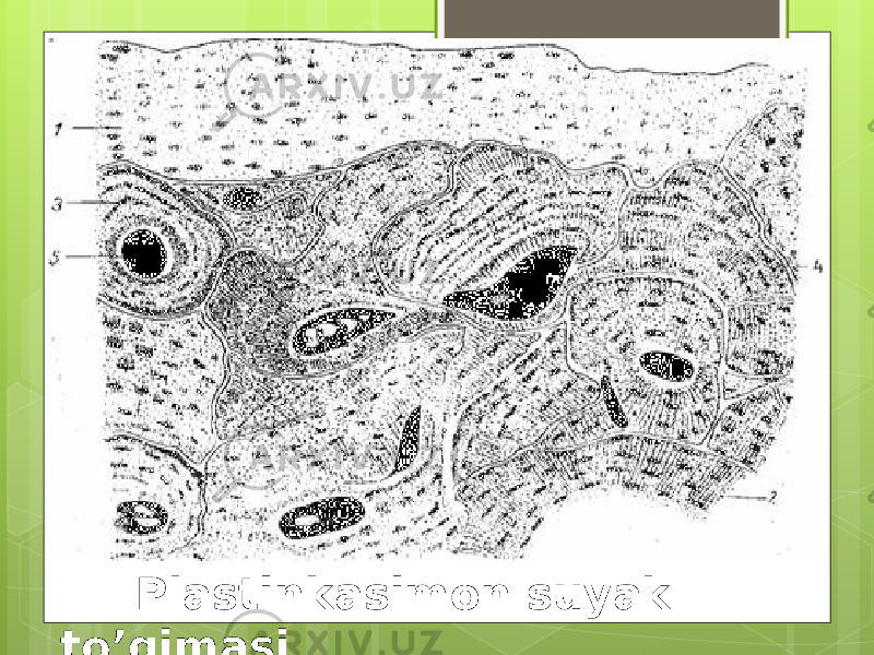  Plastinkasimon suyak to’qimasi 