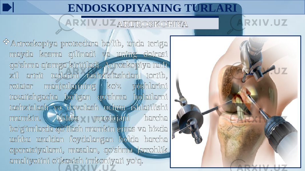 ENDOSKOPIYANING TURLARI ARTROSKOPIYA  Artroskopiya protsedura bo&#39;lib, unda teriga mayda kesma qilinadi va uning doirasi qo&#39;shma qismga kiritiladi. Artroskopiya turli xil artrit turlarini tashxislashdan tortib, rotator manjetlarining ko&#39;z yoshlarini tuzatishgacha bo&#39;lgan qo&#39;shma holatlarni tashxislash va davolash uchun ishlatilishi mumkin. Ushbu muolajani barcha bo&#39;g&#39;imlarda qo&#39;llash mumkin emas va bizda ushbu usuldan foydalangan holda barcha operatsiyalarni, masalan, qo&#39;shma jarrohlik amaliyotini o&#39;tkazish imkoniyati yo&#39;q. 