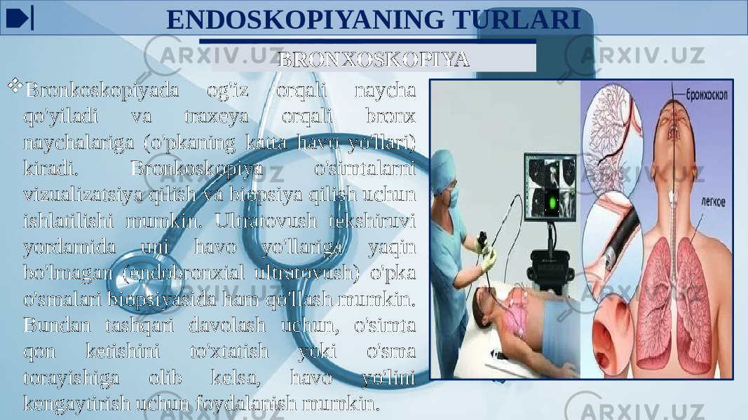 ENDOSKOPIYANING TURLARI BRONXOSKOPIYA  Bronkoskopiyada og&#39;iz orqali naycha qo&#39;yiladi va traxeya orqali bronx naychalariga (o&#39;pkaning katta havo yo&#39;llari) kiradi. Bronkoskopiya o&#39;simtalarni vizualizatsiya qilish va biopsiya qilish uchun ishlatilishi mumkin. Ultratovush tekshiruvi yordamida uni havo yo&#39;llariga yaqin bo&#39;lmagan (endobronxial ultratovush) o&#39;pka o&#39;smalari biopsiyasida ham qo&#39;llash mumkin. Bundan tashqari davolash uchun, o&#39;simta qon ketishini to&#39;xtatish yoki o&#39;sma torayishiga olib kelsa, havo yo&#39;lini kengaytirish uchun foydalanish mumkin. 