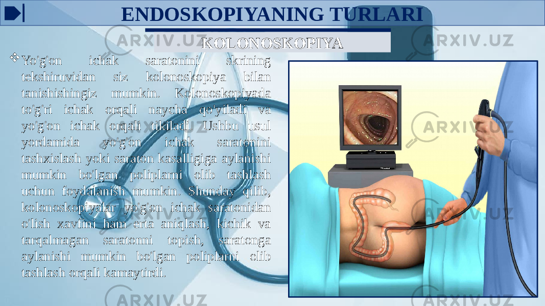 ENDOSKOPIYANING TURLARI KOLONOSKOPIYA  Yo&#39;g&#39;on ichak saratonini skrining tekshiruvidan siz kolonoskopiya bilan tanishishingiz mumkin. Kolonoskopiyada to&#39;g&#39;ri ichak orqali naycha qo&#39;yiladi va yo&#39;g&#39;on ichak orqali tikiladi. Ushbu usul yordamida yo&#39;g&#39;on ichak saratonini tashxislash yoki saraton kasalligiga aylanishi mumkin bo&#39;lgan poliplarni olib tashlash uchun foydalanish mumkin. Shunday qilib, kolonoskopiyalar yo&#39;g&#39;on ichak saratonidan o&#39;lish xavfini ham erta aniqlash, kichik va tarqalmagan saratonni topish, saratonga aylanishi mumkin bo&#39;lgan poliplarni olib tashlash orqali kamaytirdi. 