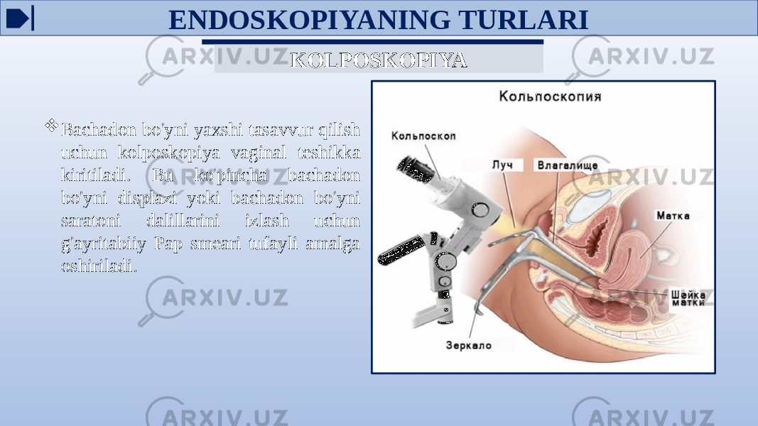 KOLPOSKOPIYA  Bachadon bo&#39;yni yaxshi tasavvur qilish uchun kolposkopiya vaginal teshikka kiritiladi. Bu ko&#39;pincha bachadon bo&#39;yni displazi yoki bachadon bo&#39;yni saratoni dalillarini izlash uchun g&#39;ayritabiiy Pap smeari tufayli amalga oshiriladi. ENDOSKOPIYANING TURLARI 