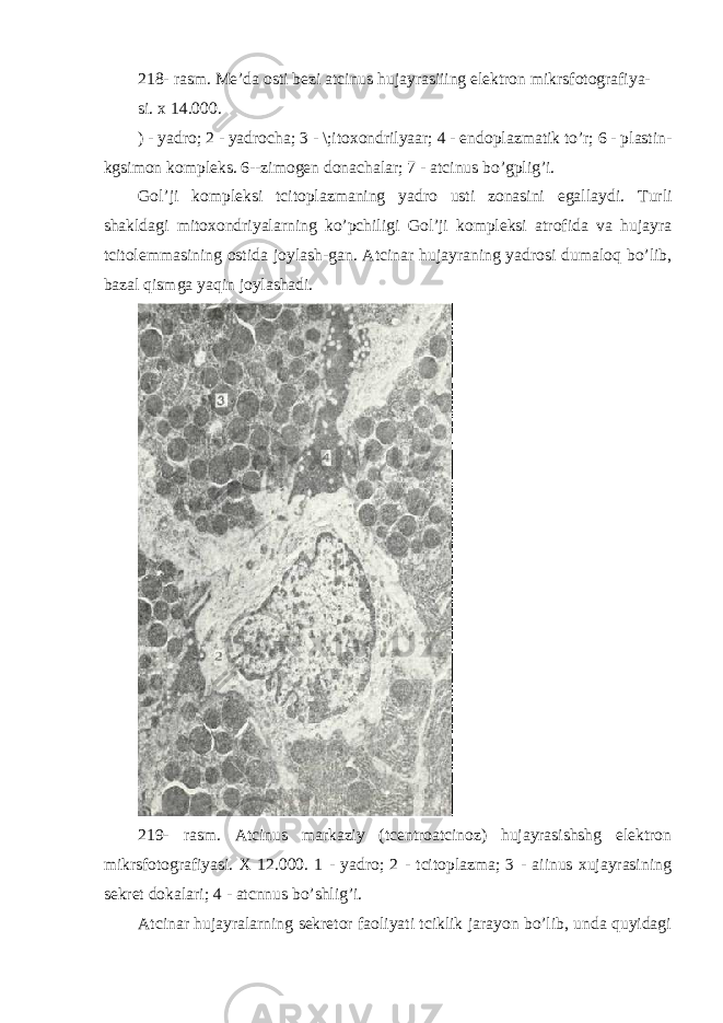 218- rasm. Me’da osti bezi atcinus hujayrasiiing elektron mikrsfotografiya- si. x 14.000. ) - yadro; 2 - yadrocha; 3 - \;itoxondrilyaar; 4 - endoplazmatik to’r; 6 - plastin- kgsimon kompleks. 6--zimogen donachalar; 7 - atcinus bo’gplig’i. Gol’ji kompleksi tcitoplazmaning yadro usti zonasini egallay d i. Turli shakldagi mitoxondriyalarning ko’pchiligi Gol’ji kompleksi atrofida va hujayra tcitolemmasining ostida joylash-gan. Atcinar hujayraning yadrosi dumaloq bo’lib, bazal qismga yaqin joylashadi. 219- rasm. Atcinus markaziy (tcentroatcinoz) hujayrasishshg elektron mikrsfotografiyasi. X 12.000. 1 - yadro; 2 - tcitoplazma; 3 - aiinus xujayrasining sekret dokalari; 4 - atcnnus bo’shlig’i. Atcinar hujayralarning sekretor faoliyati tciklik jarayon bo’lib, unda quyidagi 