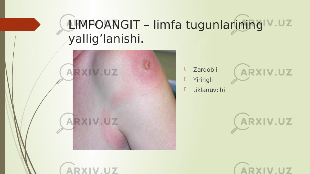 LIMFOANGIT – limfa tugunlarining yallig’lanishi.  Zardobli  Yiringli  tiklanuvchi 