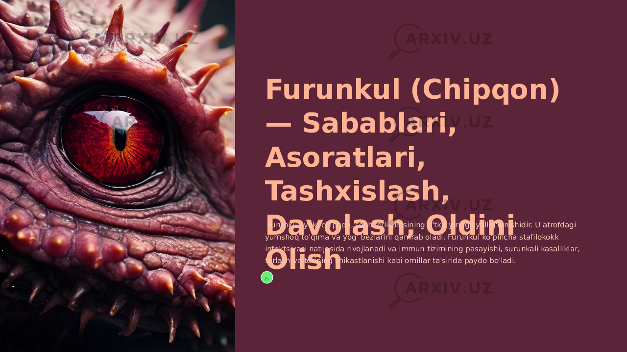 Furunkul (Chipqon) — Sabablari, Asoratlari, Tashxislash, Davolash, Oldini Olish Furunkul, yoki chipqon, soch follikulasining o&#39;tkir yiringli yallig&#39;lanishidir. U atrofdagi yumshoq to&#39;qima va yog&#39; bezlarini qamrab oladi. Furunkul ko&#39;pincha stafilokokk infektsiyasi natijasida rivojlanadi va immun tizimining pasayishi, surunkali kasalliklar, terlash va terining shikastlanishi kabi omillar ta&#39;sirida paydo bo&#39;ladi. FI 