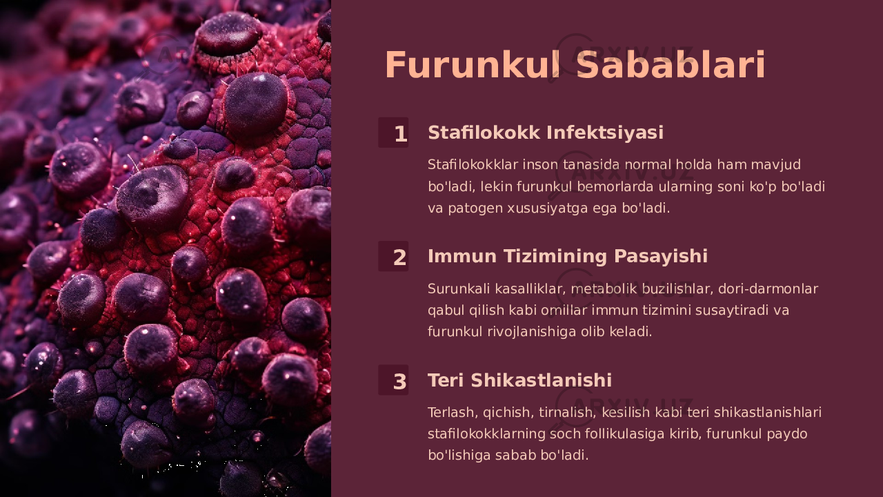 Furunkul Sabablari 1 Stafilokokk Infektsiyasi Stafilokokklar inson tanasida normal holda ham mavjud bo&#39;ladi, lekin furunkul bemorlarda ularning soni ko&#39;p bo&#39;ladi va patogen xususiyatga ega bo&#39;ladi. 2 Immun Tizimining Pasayishi Surunkali kasalliklar, metabolik buzilishlar, dori-darmonlar qabul qilish kabi omillar immun tizimini susaytiradi va furunkul rivojlanishiga olib keladi. 3 Teri Shikastlanishi Terlash, qichish, tirnalish, kesilish kabi teri shikastlanishlari stafilokokklarning soch follikulasiga kirib, furunkul paydo bo&#39;lishiga sabab bo&#39;ladi. 