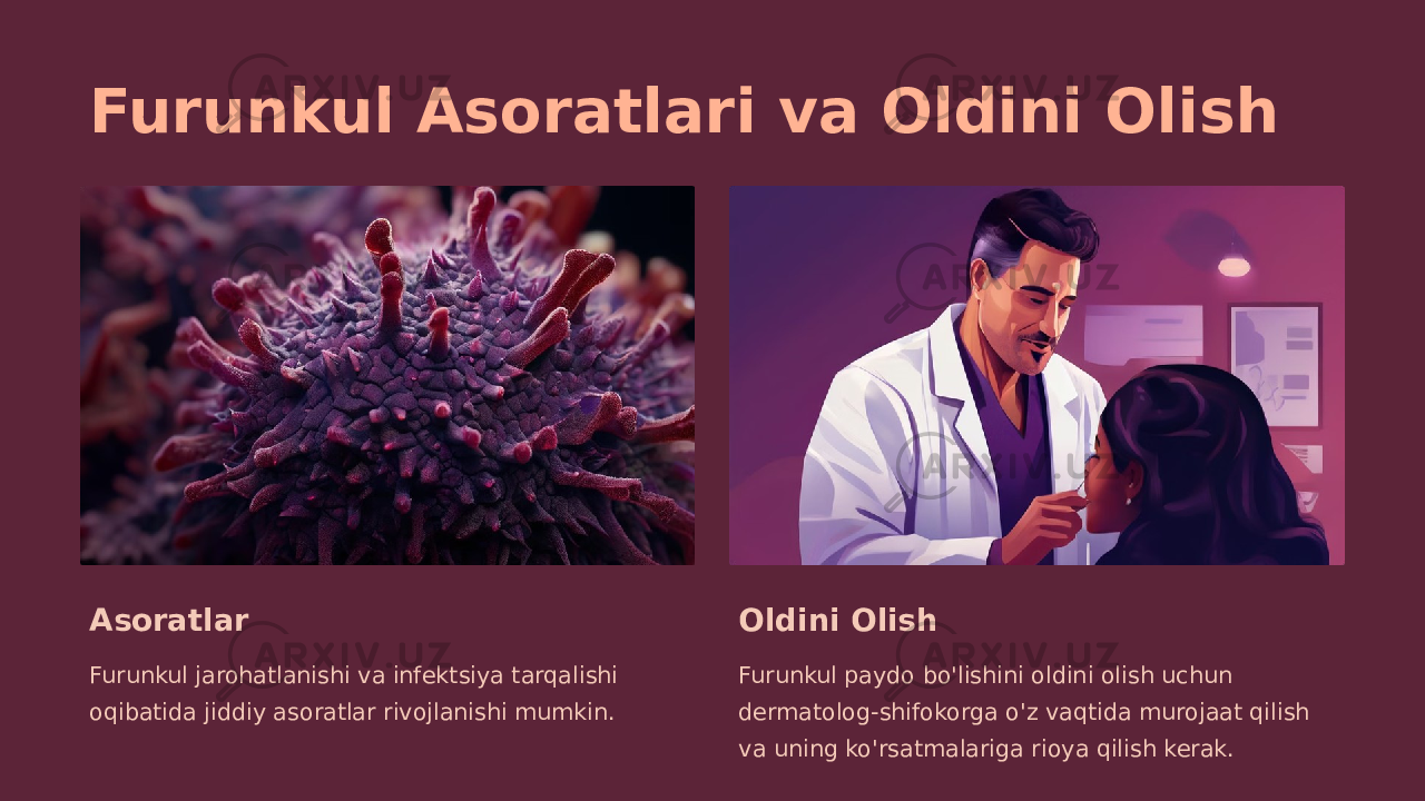 Furunkul Asoratlari va Oldini Olish Asoratlar Furunkul jarohatlanishi va infektsiya tarqalishi oqibatida jiddiy asoratlar rivojlanishi mumkin. Oldini Olish Furunkul paydo bo&#39;lishini oldini olish uchun dermatolog-shifokorga o&#39;z vaqtida murojaat qilish va uning ko&#39;rsatmalariga rioya qilish kerak. 