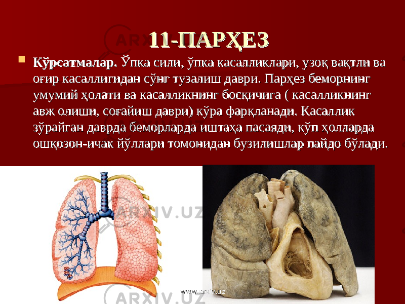 11-ПАРҲЕЗ11-ПАРҲЕЗ  Кўрсатмалар.Кўрсатмалар. Ўпка сили, ўпка касалликлари, узоқ вақтли ва Ўпка сили, ўпка касалликлари, узоқ вақтли ва оғир касаллигидан сўнг тузалиш даври. Парҳез беморнинг оғир касаллигидан сўнг тузалиш даври. Парҳез беморнинг умумий ҳолати ва касалликнинг босқичига ( касалликнинг умумий ҳолати ва касалликнинг босқичига ( касалликнинг авж олиши, соғайиш даври) кўра фарқланади. Касаллик авж олиши, соғайиш даври) кўра фарқланади. Касаллик зўрайган даврда беморларда иштаҳа пасаяди, кўп ҳолларда зўрайган даврда беморларда иштаҳа пасаяди, кўп ҳолларда ошқозон-ичак йўллари томонидан бузилишлар пайдо бўлади.ошқозон-ичак йўллари томонидан бузилишлар пайдо бўлади. www.arxiv.uzwww.arxiv.uz 