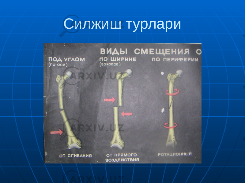 Силжиш турлари 