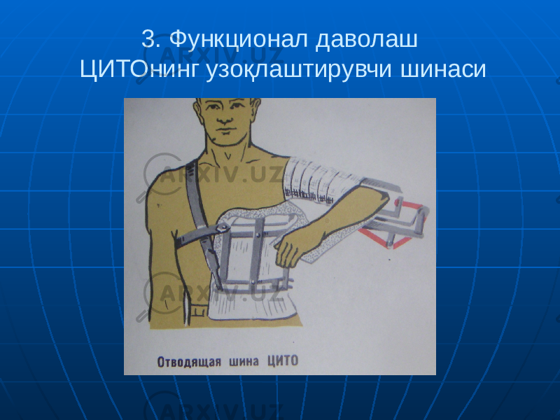 3. Функционал даволаш ЦИТОнинг узоқлаштирувчи шинаси 