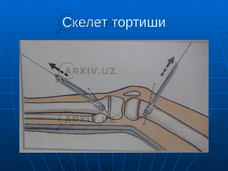 Скелет тортиши 