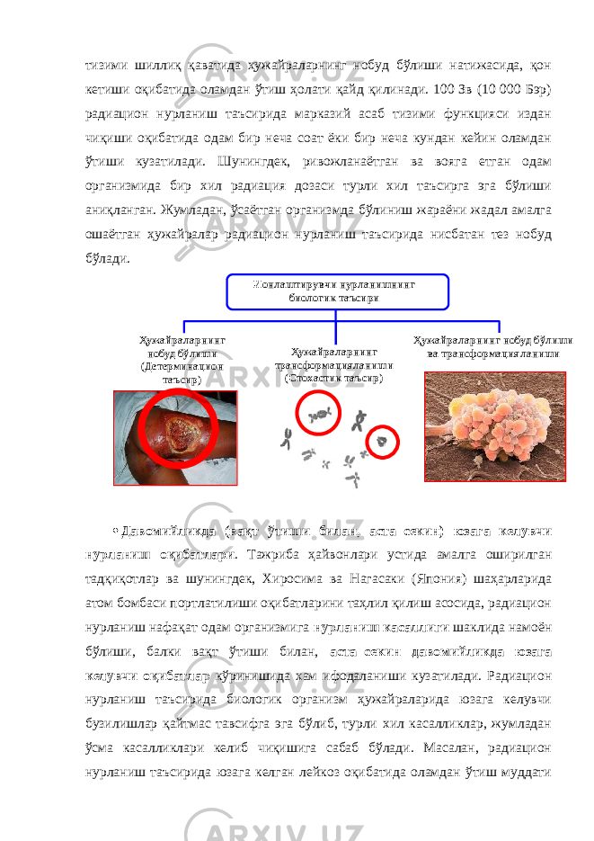 тизими шиллиқ қаватида ҳужайраларнинг нобуд бўлиши натижасида, қон кетиши оқибатида оламдан ўтиш ҳолати қайд қилинади. 100 Зв (10 000 Бэр) радиацион нурланиш таъсирида марказий асаб тизими функцияси издан чиқиши оқибатида одам бир неча соат ёки бир неча кундан кейин оламдан ўтиши кузатилади. Шунингдек, ривожланаётган ва вояга етган одам организмида бир хил радиация дозаси турли хил таъсирга эга бўлиши аниқланган. Жумладан, ўсаётган организмда бўлиниш жараёни жадал амалга ошаётган ҳужайралар радиацион нурланиш таъсирида нисбатан тез нобуд бўлади. Ҳужайраларнинг нобуд бўлиши ( Детерминацион таъсир ) Ионлаштирувчи нурланишнинг биологик таъсири Ҳужайраларнинг трансформацияланиши ( Стохастик таъсир ) Ҳужайраларнинг нобуд бўлиши ва трансформацияланиши  Давомийликда (вақт ўтиши билан, аста–секин) юзага келувчи нурланиш оқибатлари . Тажриба ҳайвонлари устида амалга оширилган тадқиқотлар ва шунингдек, Хиросима ва Нагасаки (Япония) шаҳарларида атом бомбаси портлатилиши оқибатларини таҳлил қилиш асосида, радиацион нурланиш нафақат одам организмига нурланиш касаллиги шаклида намоён бўлиши, балки вақт ўтиши билан, аста–секин давомийликда юзага келувчи оқибатлар кўринишида хам ифодаланиши кузатилади. Радиацион нурланиш таъсирида биологик организм ҳужайраларида юзага келувчи бузилишлар қайтмас тавсифга эга бўлиб, турли хил касалликлар, жумладан ўсма касалликлари келиб чиқишига сабаб бўлади. Масалан, радиацион нурланиш таъсирида юзага келган лейкоз оқибатида оламдан ўтиш муддати 