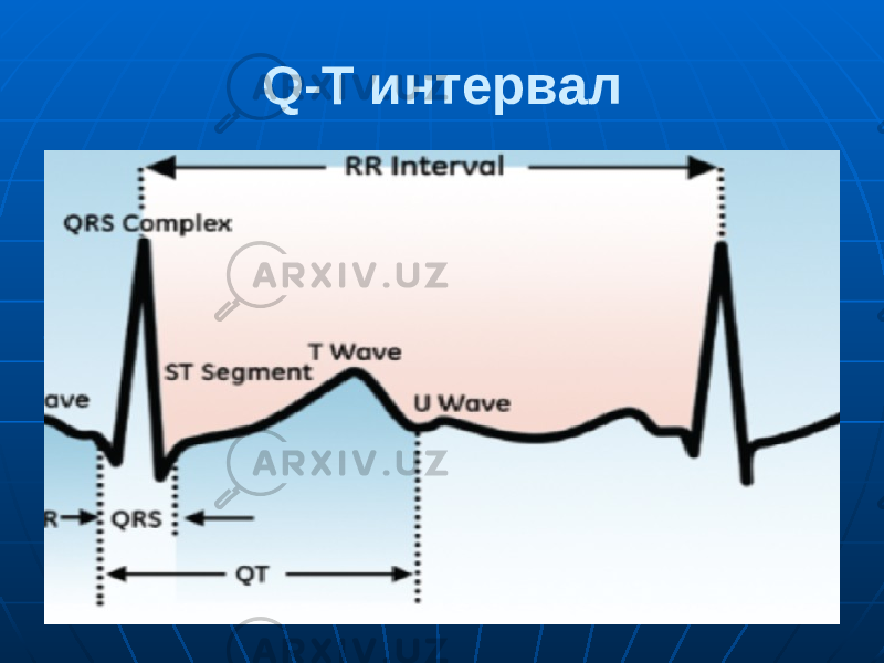 Q-T интервал . 