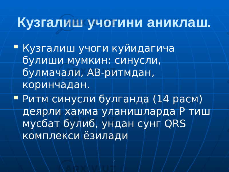 .Кузгалиш учогини аниклаш.  Кузгалиш учоги куйидагича булиши мумкин: синусли, булмачали, АВ-ритмдан, коринчадан.  Ритм синусли булганда (14 расм) деярли хамма уланишларда Р тиш мусбат булиб, ундан сунг QRS комплекси ёзилади 