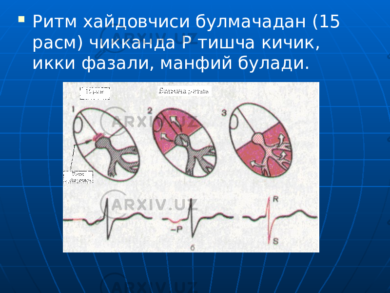  Ритм хайдовчиси булмачадан (15 расм) чикканда Р тишча кичик, икки фазали, манфий булади. 