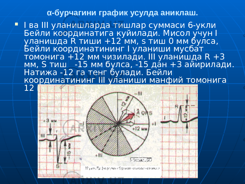 БухМИ УАВ тайёрлаш кафедраси ассистенти Солиев Алишер Уроковичα-бурчагини график усулда аниклаш.  I ва III уланишларда тишлар суммаси 6-укли Бейли координатига куйилади. Мисол учун I уланишда R тиши +12 мм, s тиш 0 мм булса, Бейли координатининг I уланиши мусбат томонига +12 мм чизилади. III уланишда R +3 мм, S тиш -15 мм булса, -15 дан +3 айирилади. Натижа -12 га тенг булади. Бейли координатининг III уланиши манфий томонига 12 мм чизилади (19 расм). 