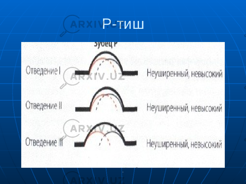 Р-тиш . 