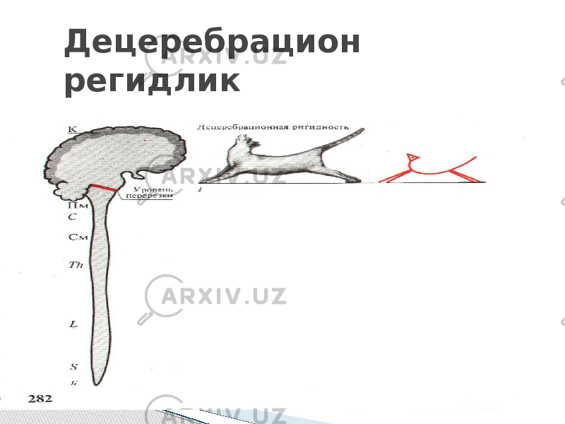 Децеребрацион регидлик 