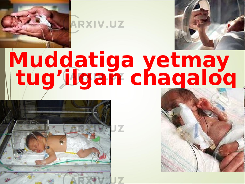 Muddatiga y etmay tug’ilgan chaqaloq 