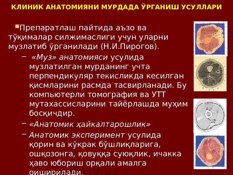 КЛИНИК АНАТОМИЯНИ МУРДАДА ЎРГАНИШ УСУЛЛАРИ  Препаратлаш пайтида аъзо ва тўқималар силжимаслиги учун уларни музлатиб ўрганилади (Н.И.Пирогов). – «Муз» анатомияси усулида музлатилган мурданинг учта перпендикуляр текисликда кесилган қисмларини расмда тасвирланади. Бу компьютерли томография ва УТТ мутахассисларини тайёрлашда муҳим босқичдир. – «Анатомик ҳайкалтарошлик» – Анатомик эксперимент усулида қорин ва кўкрак бўшлиқларига, ошқозонга, қовуққа суюқлик, ичакка ҳаво юбориш орқали амалга оиширилади. 