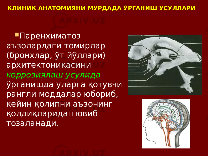 КЛИНИК АНАТОМИЯНИ МУРДАДА ЎРГАНИШ УСУЛЛАРИ  Паренхиматоз аъзолардаги томирлар (бронхлар, ўт йўллари) архитектоникасини коррозиялаш усулида ўрганишда уларга қотувчи рангли моддалар юбориб, кейин қолипни аъзонинг қолдиқларидан ювиб тозаланади. 