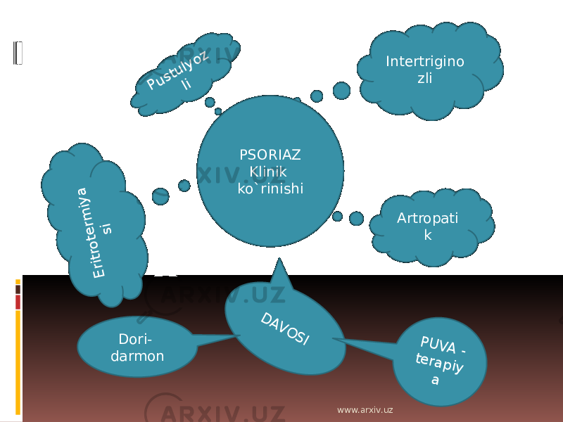 Intertrigino zli Artropati kPustulyoz li E ritro te rm iy a si D AV O SIPSORIAZ Klinik ko`rinishi P U V A - te ra p iy a Dori- darmon www.arxiv.uz 