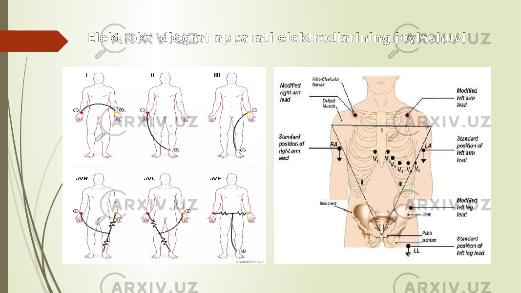 Elektrokardiograf apparati elektrodlarining joylashuvi 