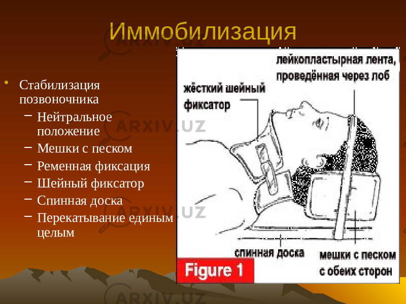 Иммобилизация • Стабилизация позвоночника – Нейтральное положение – Мешки с песком – Ременная фиксация – Шейный фиксатор – Спинная доска – Перекатывание единым целым 