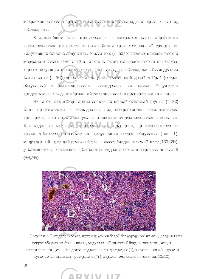 макроскопические параметры почек белых беспородных крыс в период наблюдения. В дальнейшем были приготовлены и микроскопически обработаны гистологические препараты из почек белых крыс контрольной группы, не получивших острого облучения. У всех них (n=30) значимых патологических морфологических изменений в почках не было, морфологических признаков, характеризующих патологические изменения, не наблюдалось.Исследуемых белых крыс (n=30) однократно облучали суммарной дозой 5 Грей (острое облучение) и морфологически исследовали их почки. Результаты представлены в виде изображений гистологических препаратов и их анализа. Из почек всех лабораторных животных первой основной группы (n=30) были приготовлены и исследованы под микроскопом гистологические препараты, в которых обнаружены различные морфологические изменения. Как видно из картины гистологического препарата, приготовленного из почки лабораторных животных, получивших острое облучение (рис. 1), медуллярный эпителий почечной ткани имеет бледно-розовый цвет (100,0%), у большинства канальцев наблюдалась гидропическая дистрофия. эпителий (86,7%). Рисунок 1. Гистологическая картина почки белой беспородный крысы, получившей острое облучение (ткань почки, медуллярный эпителий бледно-розового цвета, в эпителии канальцев наблюдалась гидропическая дистрофия (1), в связи с чем обнаружено сужение канальцевых пространств (2) ), окраска гематоксилин-эозином, 10х10). 58 1 1 2 