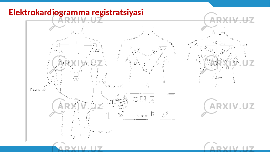Elektrokardiogramma registratsiyasi 