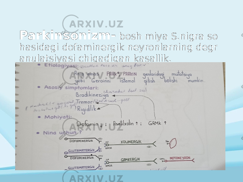 Parkinsonizm- bosh miya S.nigra so hasidagi dofaminergik neyronlarning degr anulatsiyasi chiqadigan kasallik. 