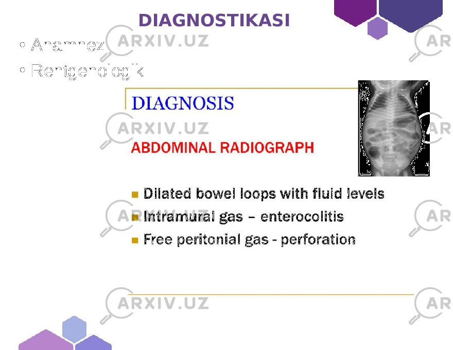  DIAGNOSTIKASI • Anamnez • Rentgenologik 