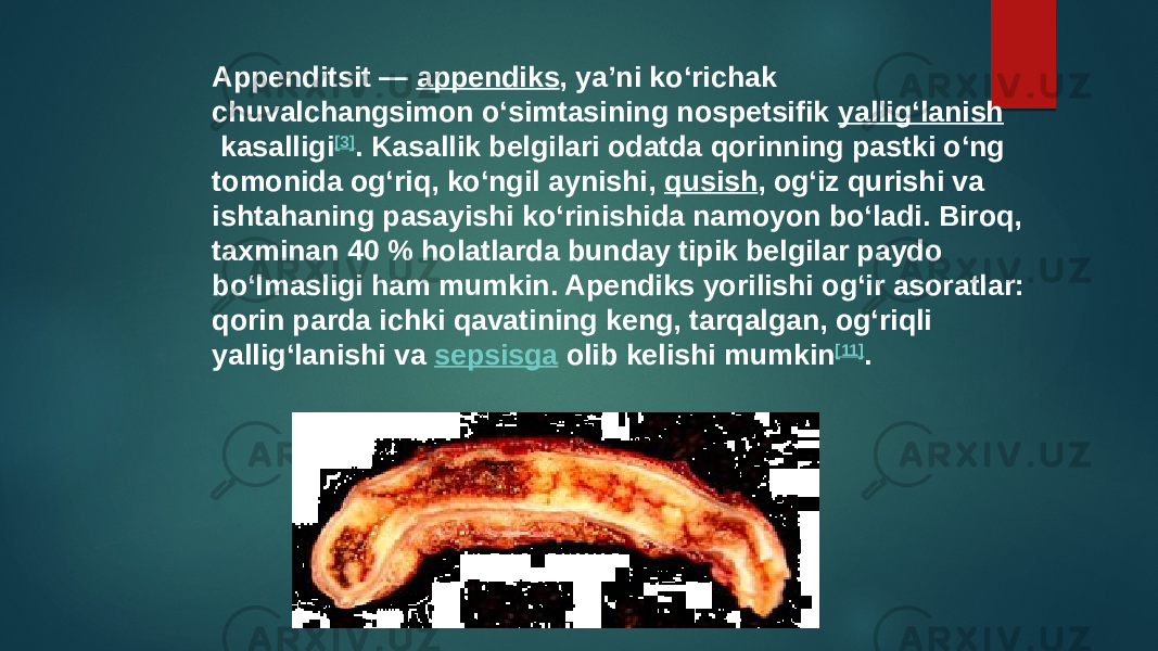 Appenditsit —  appendiks , yaʼni koʻrichak chuvalchangsimon oʻsimtasining nospetsifik  yalligʻlanish  kasalligi [3] . Kasallik belgilari odatda qorinning pastki oʻng tomonida ogʻriq, koʻngil aynishi,  qusish , ogʻiz qurishi va ishtahaning pasayishi koʻrinishida namoyon boʻladi. Biroq, taxminan 40 % holatlarda bunday tipik belgilar paydo boʻlmasligi ham mumkin. Apendiks yorilishi ogʻir asoratlar: qorin parda ichki qavatining keng, tarqalgan, ogʻriqli yalligʻlanishi va  sepsisga  olib kelishi mumkin [11] . 