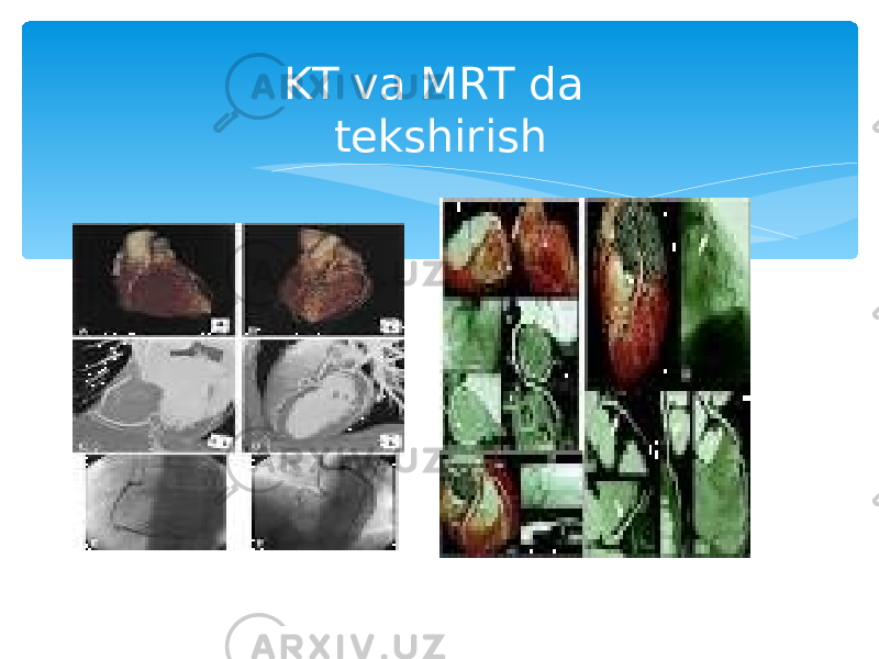 KT va MRT da tekshirish 