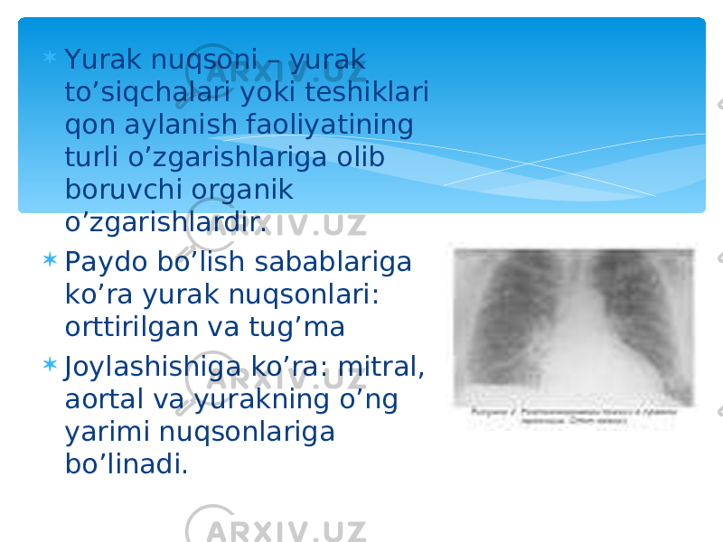  Yurak nuqsoni – yurak to’siqchalari yoki teshiklari qon aylanish faoliyatining turli o’zgarishlariga olib boruvchi organik o’zgarishlardir.  Paydo bo’lish sabablariga ko’ra yurak nuqsonlari: orttirilgan va tug’ma  Joylashishiga ko’ra: mitral, aortal va yurakning o’ng yarimi nuqsonlariga bo’linadi. 