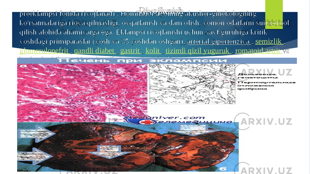 preeklampsi fonida rivojlanadi . Homilador ayolning akusher-ginekologning ko&#39;rsatmalariga rioya qilmasligi, ovqatlanish va dam olish, yomon odatlarni suiiste&#39;mol qilish alohida ahamiyatga ega. Eklampsi rivojlanishi uchun xavf guruhiga kritik yoshdagi primiparaslar (yosh va 35 yoshdan oshgan), arterial gipertenziya , semizlik , glomerulonefrit , qandli diabet , gastrit , kolit , tizimli qizil yuguruk , romatoid artrit va boshqalar bilan og&#39;rigan homilador ayollar kiradi. Rivojlanish 