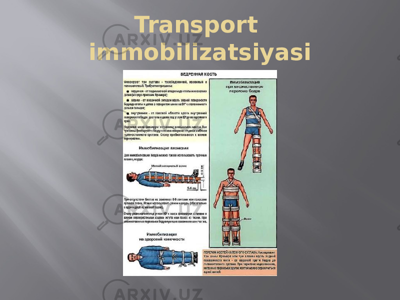 Transport immobilizatsiyasi 