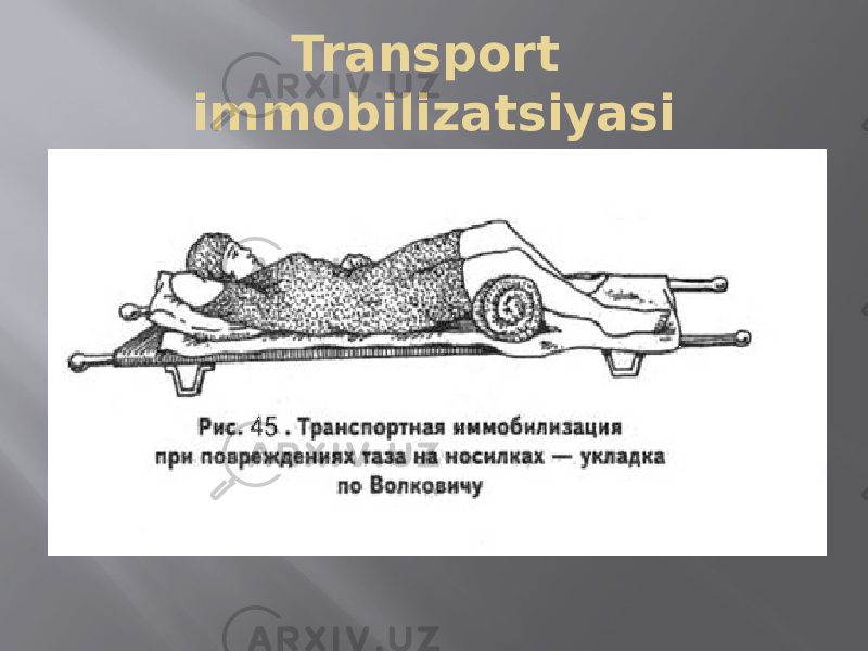 Transport immobilizatsiyasi 