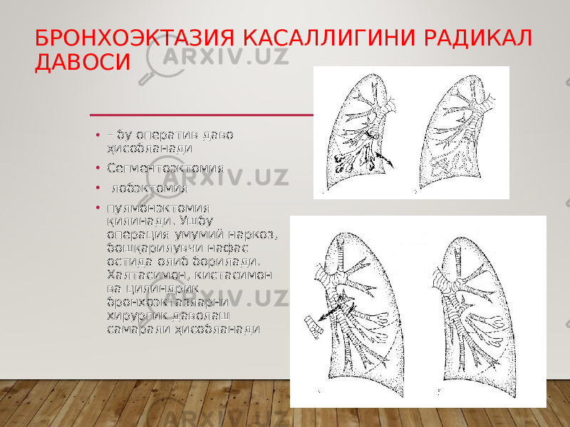 БРОНХОЭКТАЗИЯ КАСАЛЛИГИНИ РАДИКАЛ ДАВОСИ • – бу оператив даво ҳисобланади • Сегментоэктомия • лобэктомия • пулмонэктомия қилинади. Ушбу операция умумий наркоз, бошқарилувчи нафас остида олиб борилади. Халтасимон, кистасимон ва цилиндрик бронхоэктазларни хирургик даволаш самарали ҳисобланади 