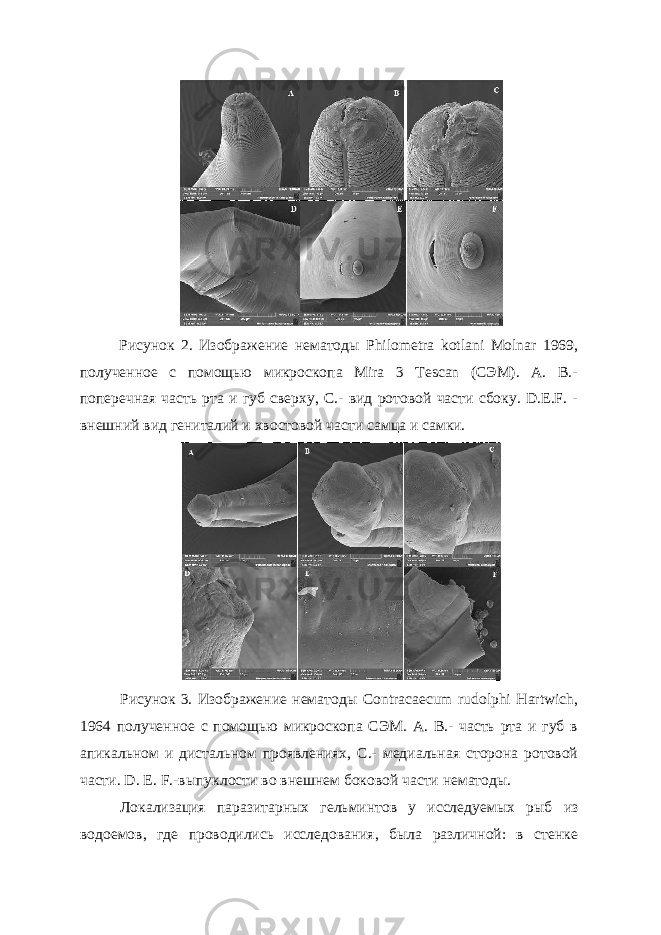 Рисунок 2. Изображение нематоды Philometra kotlani Molnar 1969, полученное с помощью микроскопа Mira 3 Tescan (СЭМ). A. B.- поперечная часть рта и губ сверху, С.- вид ротовой части сбоку. D.E.F. - внешний вид гениталий и хвостовой части самца и самки. Рисунок 3. Изображение нематоды Contracaecum rudolphi Hartwich, 1964 полученное с помощью микроскопа СЭМ. A. B.- часть рта и губ в апикальном и дистальном проявлениях, C.- медиальная сторона ротовой части. D. E. F.-выпуклости во внешнем боковой части нематоды. Локализация паразитарных гельминтов у исследуемых рыб из водоемов, где проводились исследования, была различной: в стенке 