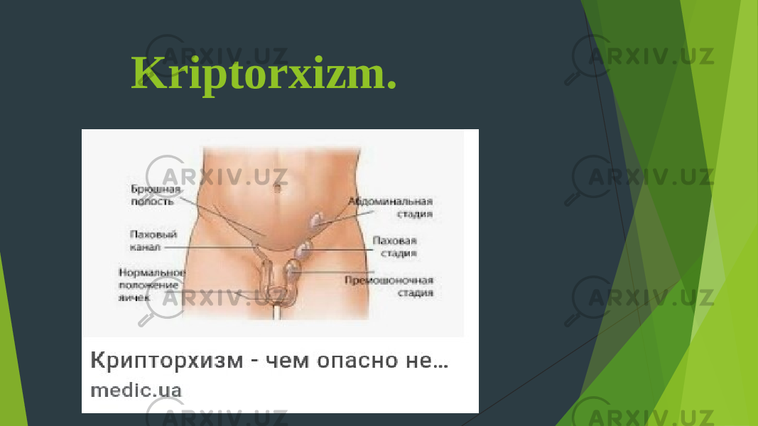  Kriptorxizm. 