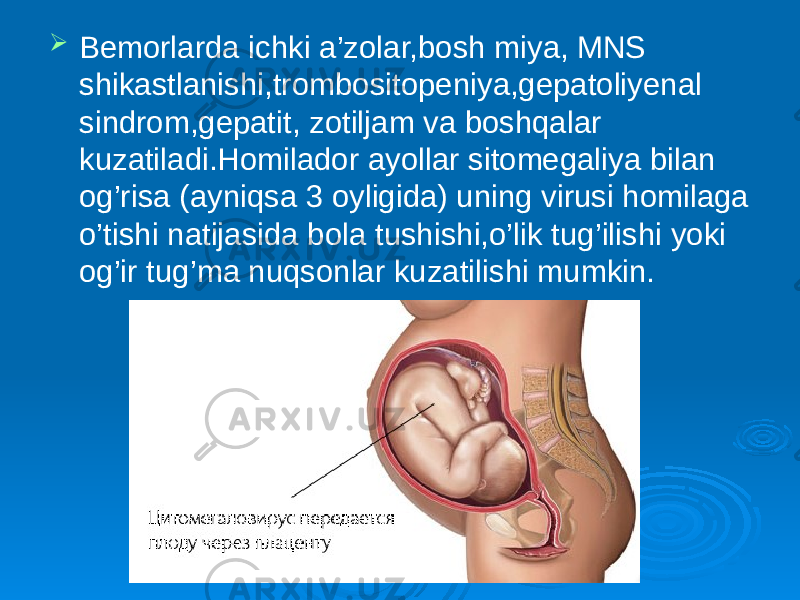  Bemorlarda ichki a’zolar,bosh miya, MNS shikastlanishi,trombositopeniya,gepatoliyenal sindrom,gepatit, zotiljam va boshqalar kuzatiladi.Homilador ayollar sitomegaliya bilan og’risa (ayniqsa 3 oyligida) uning virusi homilaga o’tishi natijasida bola tushishi,o’lik tug’ilishi yoki og’ir tug’ma nuqsonlar kuzatilishi mumkin. 