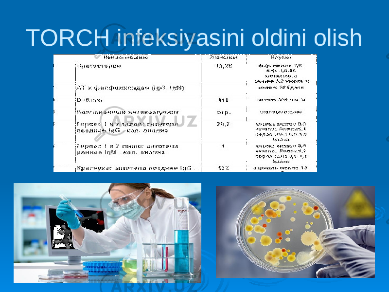 TORCH infeksiyasini oldini olish 