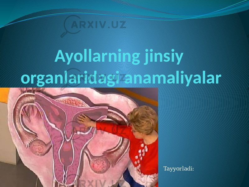 Ayollarning jinsiy organlaridagi anamaliyalar Tayyorladi: 