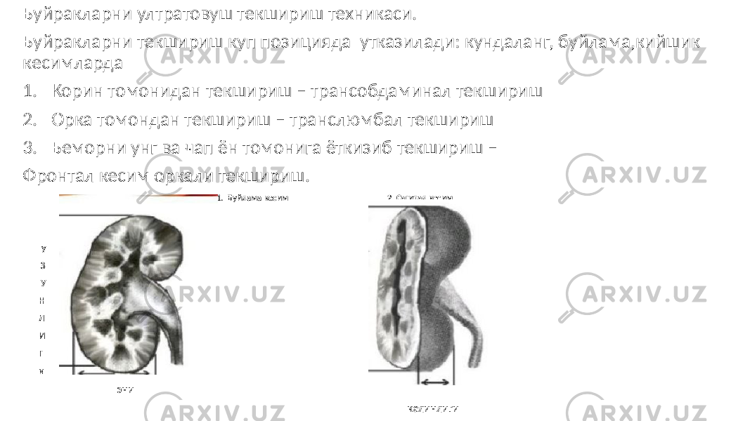 Буйракларни ултратовуш текшириш техникаси. Буйракларни текшириш куп позицияда утказилади: кундаланг, буйлама,кийшик кесимларда 1. Корин томонидан текшириш – трансобдаминал текшириш 2. Орка томондан текшириш – транслюмбал текшириш 3. Беморни унг ва чап ён томонига ёткизиб текшириш – Фронтал кесим оркали текшириш. 1. Буйлама кесим 2. Сагитал кесим у З У Н Л И Г и эни калинлиги 