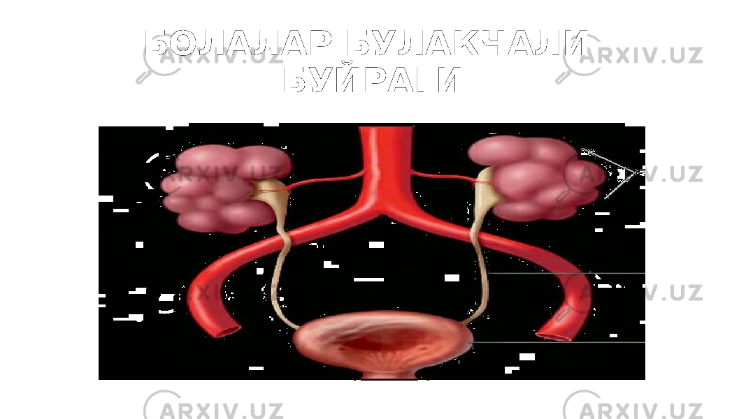 БОЛАЛАР БУЛАКЧАЛИ БУЙРАГИ 