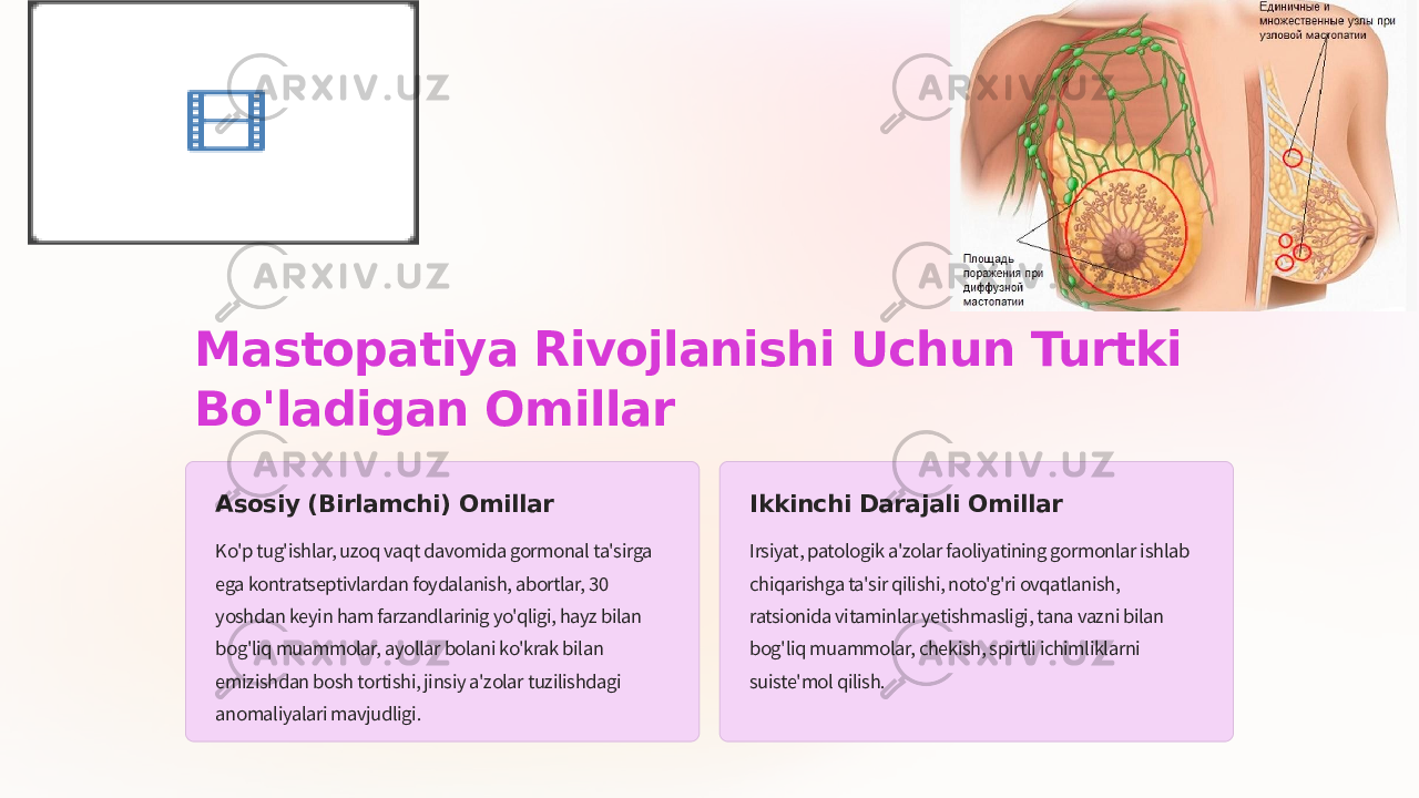 Mastopatiya Rivojlanishi Uchun Turtki Bo&#39;ladigan Omillar Asosiy (Birlamchi) Omillar Ko&#39;p tug&#39;ishlar, uzoq vaqt davomida gormonal ta&#39;sirga ega kontratseptivlardan foydalanish, abortlar, 30 yoshdan keyin ham farzandlarinig yo&#39;qligi, hayz bilan bog&#39;liq muammolar, ayollar bolani ko&#39;krak bilan emizishdan bosh tortishi, jinsiy a&#39;zolar tuzilishdagi anomaliyalari mavjudligi. Ikkinchi Darajali Omillar Irsiyat, patologik a&#39;zolar faoliyatining gormonlar ishlab chiqarishga ta&#39;sir qilishi, noto&#39;g&#39;ri ovqatlanish, ratsionida vitaminlar yetishmasligi, tana vazni bilan bog&#39;liq muammolar, chekish, spirtli ichimliklarni suiste&#39;mol qilish. 