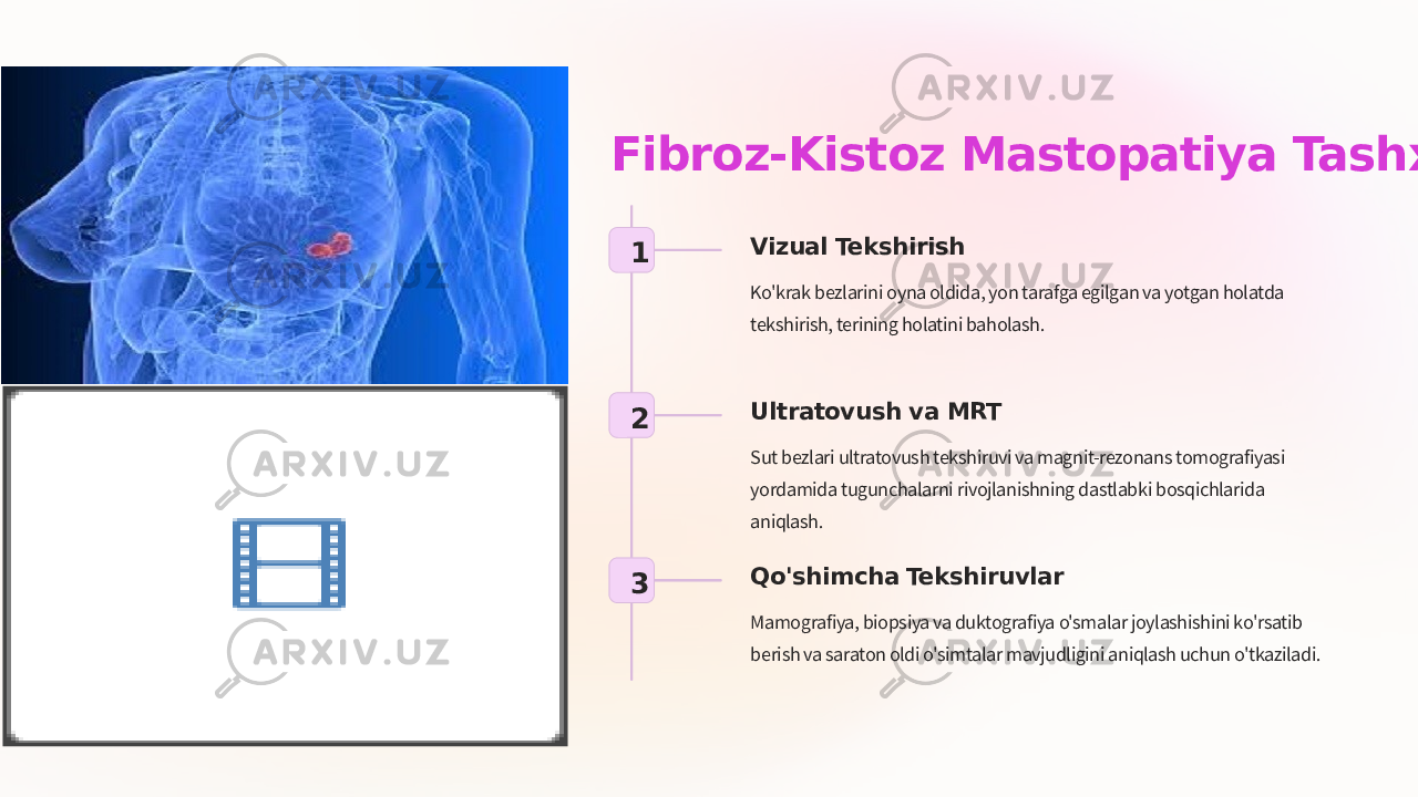 Fibroz-Kistoz Mastopatiya Tashxisi 1 Vizual Tekshirish Ko&#39;krak bezlarini oyna oldida, yon tarafga egilgan va yotgan holatda tekshirish, terining holatini baholash. 2 Ultratovush va MRT Sut bezlari ultratovush tekshiruvi va magnit-rezonans tomografiyasi yordamida tugunchalarni rivojlanishning dastlabki bosqichlarida aniqlash. 3 Qo&#39;shimcha Tekshiruvlar Mamografiya, biopsiya va duktografiya o&#39;smalar joylashishini ko&#39;rsatib berish va saraton oldi o&#39;simtalar mavjudligini aniqlash uchun o&#39;tkaziladi. 