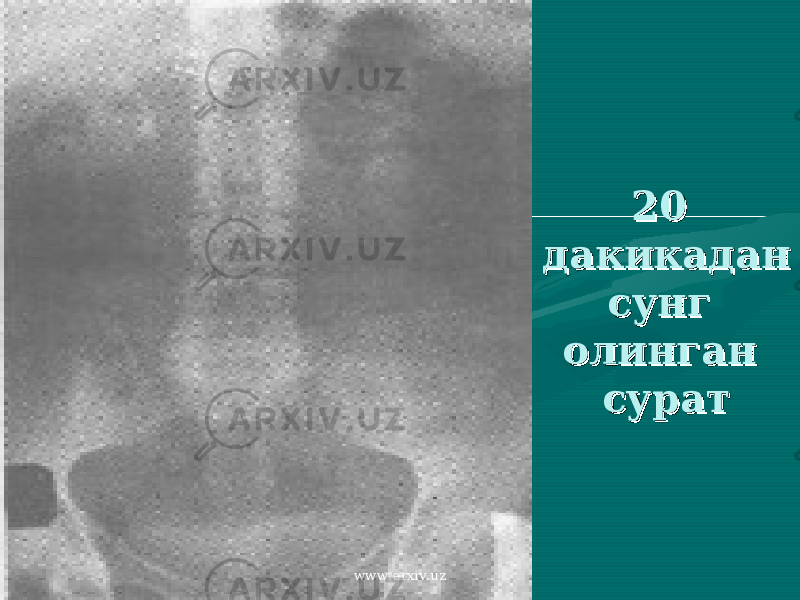 20 20 дакикадан дакикадан сунг сунг олинган олинган суратсурат www.arxiv.uz 